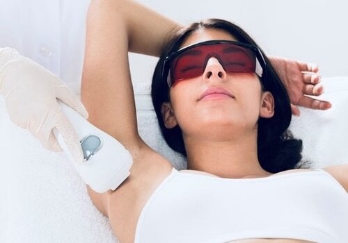 Diode laser hair removal